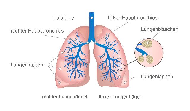 Wie sich Lungenkrebs im Endstadium auf den Körper auswirkt Wie sich Lungenkrebs im Endstadium auf den Körper auswirkt