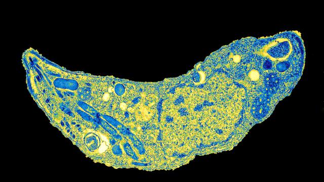 Toxoplasma gondii: Der Parasit und seine Auswirkungen auf die Gesundheit Toxoplasma gondii: Der Parasit und seine Auswirkungen auf die Gesundheit