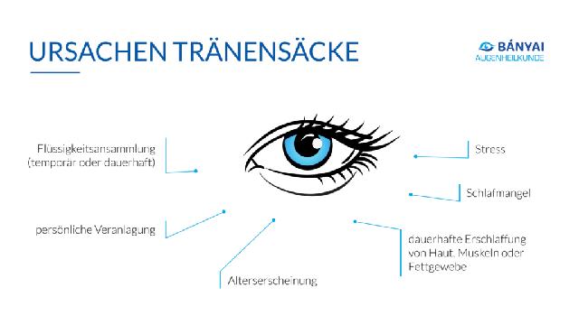 Effektive Behandlungsmöglichkeiten bei Tränensäcken Effektive Behandlungsmöglichkeiten bei Tränensäcken