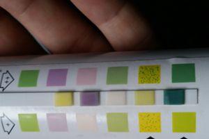 Was eine dunkelgrüne Verfärbung beim Combur Test HB aussagt Was eine dunkelgrüne Verfärbung beim Combur Test HB aussagt