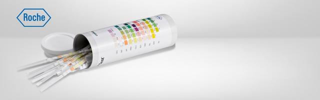 Combur Test HB: Dunkelgrüne Verfärbung bedeutet erhöhten Zuckergehalt Combur Test HB: Dunkelgrüne Verfärbung bedeutet erhöhten Zuckergehalt