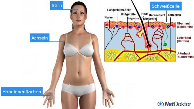 Schwitzen im Sommer: Tipps und Behandlungsmöglichkeiten bei übermäßiger Schweißproduktion