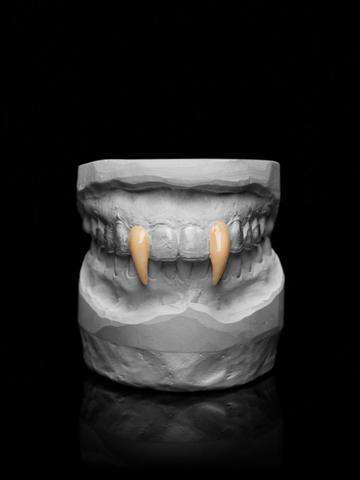 Sicherheit geht vor: Warum professionell angefertigte Vampirzähne besser sind Sicherheit geht vor: Warum professionell angefertigte Vampirzähne besser sind