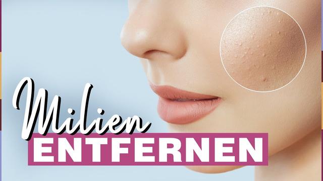 Milien Entfernen Kosmetikerin In Der Nähe Video: Milien selbst entfernen - Tipps und Tricks für die richtige
