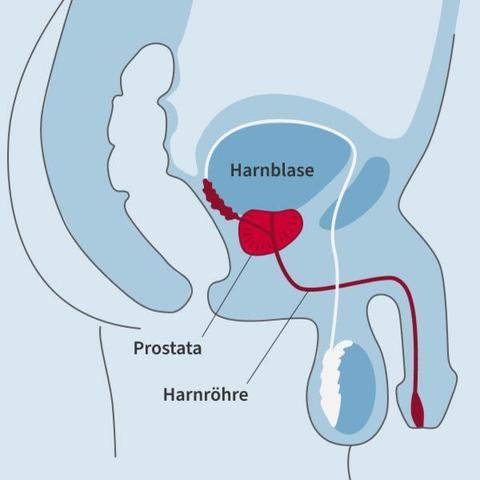 Richtlinien für das Autofahren nach einer Prostataoperation Richtlinien für das Autofahren nach einer Prostataoperation