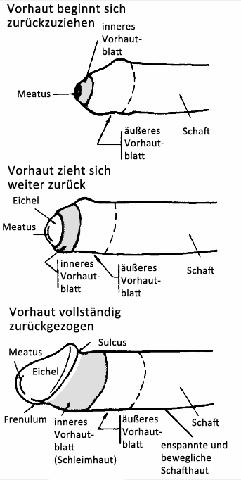 "Vorhaut zurückziehen: Wann ist der richtige Zeitpunkt?" "Vorhaut zurückziehen: Wann ist der richtige Zeitpunkt?"
