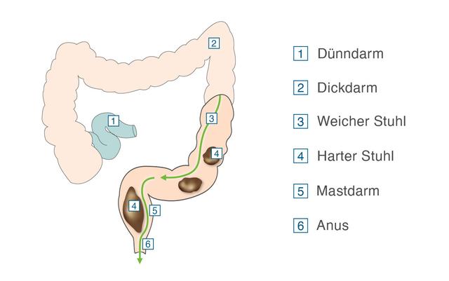 Wie lange dauert es, bis kein flüssiger Stuhl oder Flüssigkeit mehr abgesetzt wird? Wie lange dauert es, bis kein flüssiger Stuhl oder Flüssigkeit mehr abgesetzt wird?