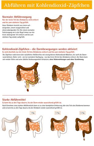 Wie lange dauert es, bis der Darm nach der Einnahme von Abführmitteln leer ist? Wie lange dauert es, bis der Darm nach der Einnahme von Abführmitteln leer ist?