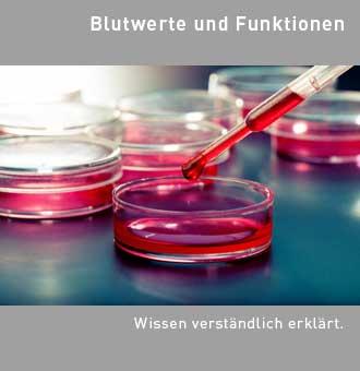 Welche Krankheiten führen zu einem erhöhten LDH-Wert? Ursachen und Bedeutung erklärt Welche Krankheiten führen zu einem erhöhten LDH-Wert? Ursachen und Bedeutung erklärt