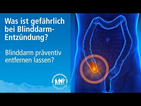 Bei Verdacht auf eine Blinddarmentzündung: Wann ist ein sofortiger Krankenhausbesuch erforderlich? Bei Verdacht auf eine Blinddarmentzündung: Wann ist ein sofortiger Krankenhausbesuch erforderlich?