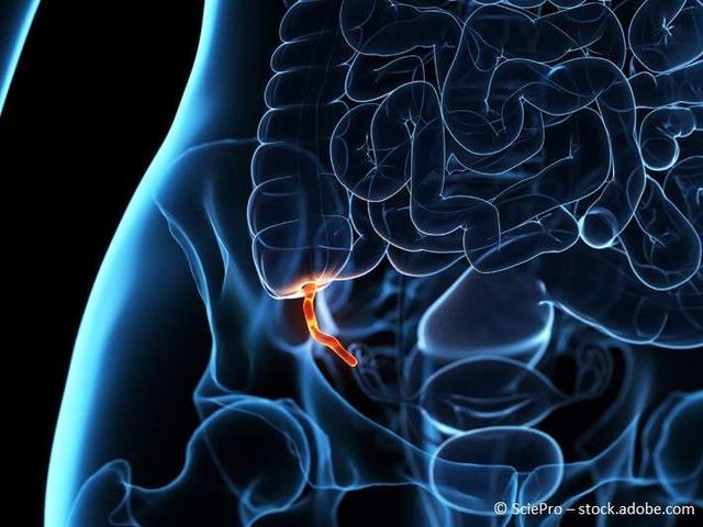 Symptome einer Blinddarmreizung: Wann ist ein Krankenhausaufenthalt notwendig? Symptome einer Blinddarmreizung: Wann ist ein Krankenhausaufenthalt notwendig?