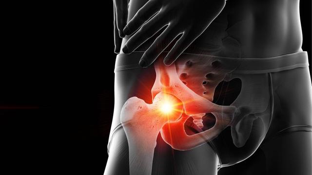 Experteninterview: Behandlungsmöglichkeiten bei Hüftarthrose Experteninterview: Behandlungsmöglichkeiten bei Hüftarthrose