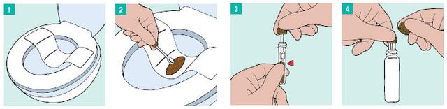 Fehlerquellen bei der Durchführung einer Stuhlprobe und wie man sie vermeidet Fehlerquellen bei der Durchführung einer Stuhlprobe und wie man sie vermeidet