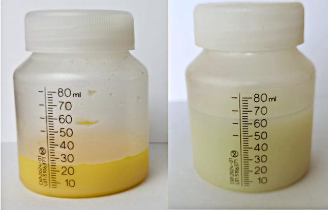 Die Rolle von Hebammen und Stillberaterinnen beim Milcheinschuss Die Rolle von Hebammen und Stillberaterinnen beim Milcheinschuss