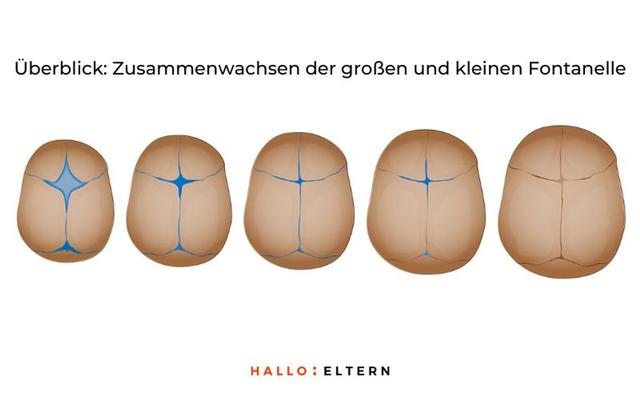 Wann schließt sich die Fontanelle? Alles, was Eltern wissen müssen Wann schließt sich die Fontanelle? Alles, was Eltern wissen müssen