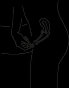 Wann beginnt die Blutung nach der Anwendung von Mifegyne? Wann beginnt die Blutung nach der Anwendung von Mifegyne?