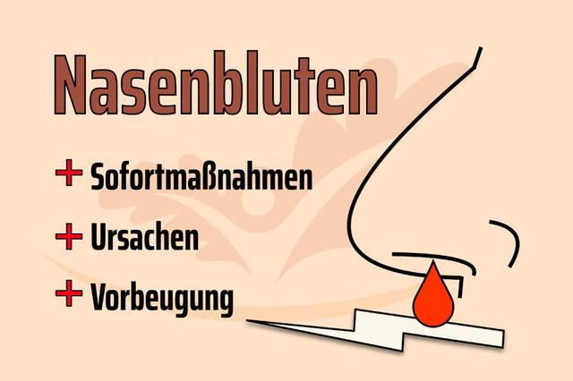 Wann sollte man bei Nasenbluten ins Krankenhaus gehen? Wann sollte man bei Nasenbluten ins Krankenhaus gehen?