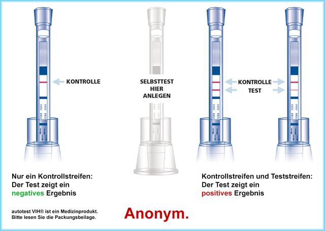 Unter welchen Umständen wird ein HIV-Test routinemäßig durchgeführt? Unter welchen Umständen wird ein HIV-Test routinemäßig durchgeführt?