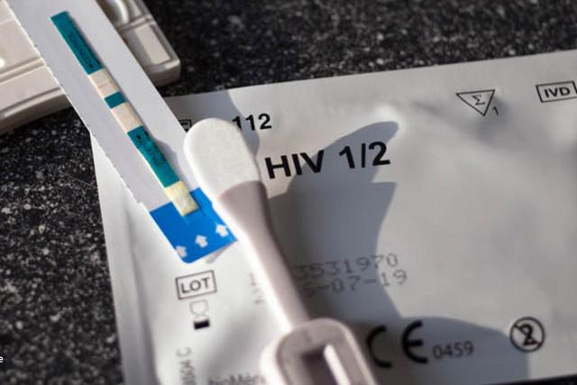 Wann wird ein HIV-Test standardmäßig vorgenommen? Wann wird ein HIV-Test standardmäßig vorgenommen?