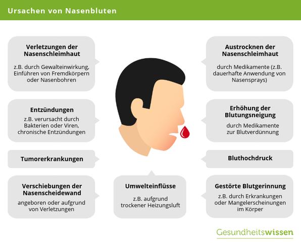 Ursachen und Risiken von Nasenbluten: Wann sollte man einen Arzt aufsuchen? Ursachen und Risiken von Nasenbluten: Wann sollte man einen Arzt aufsuchen?