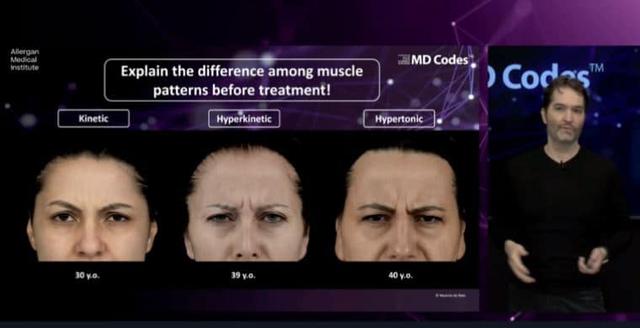 Wie schnell zeigt sich der Effekt von Botox? Wie schnell zeigt sich der Effekt von Botox?