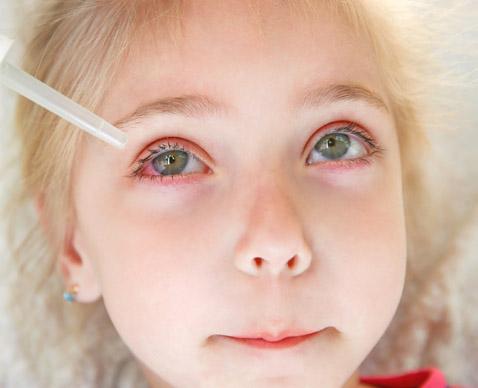 Wie erkenne ich, wann mein Kind mit einer Bindehautentzündung zum Arzt muss? Wie erkenne ich, wann mein Kind mit einer Bindehautentzündung zum Arzt muss?