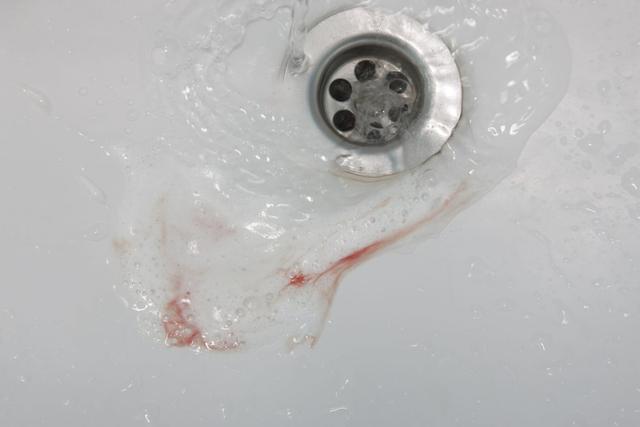 Wann ist es notwendig, wegen Blut im Erbrochenen einen Arzt aufzusuchen? Wann ist es notwendig, wegen Blut im Erbrochenen einen Arzt aufzusuchen?