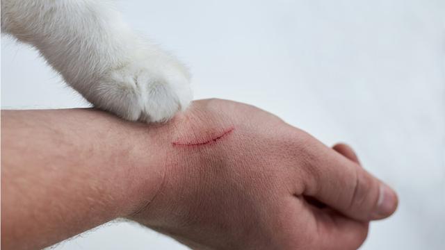 Behandlung eines Katzenbisses: Wann sollte man ärztlichen Rat suchen? Behandlung eines Katzenbisses: Wann sollte man ärztlichen Rat suchen?