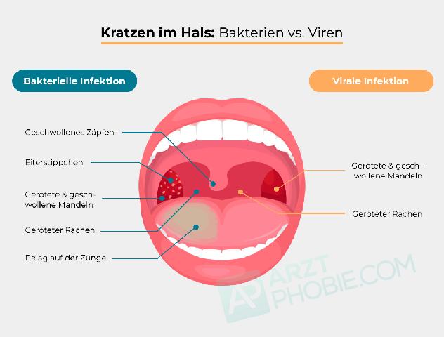 Symptome einer Rachenentzündung: Wann ist ein Besuch beim Arzt notwendig?