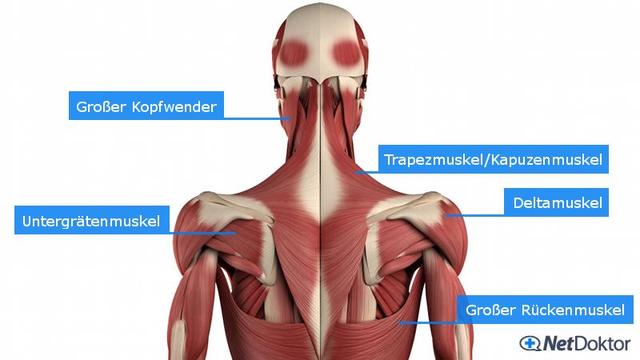 Ab wann sind steife Nackenschmerzen ein Fall für den Arzt? Ab wann sind steife Nackenschmerzen ein Fall für den Arzt?