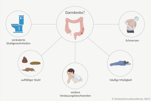 Darmkrebs-Symptom: Wie sieht das Blut im Stuhl aus? Darmkrebs-Symptom: Wie sieht das Blut im Stuhl aus?
