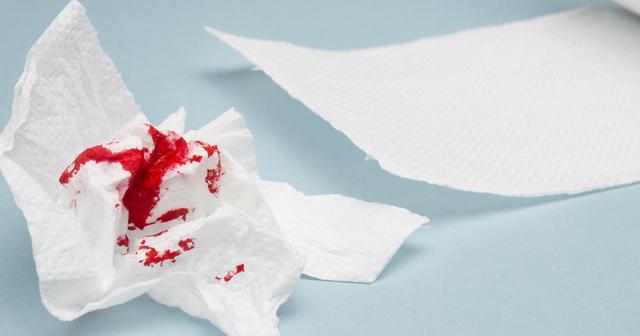 Erkennen von Darmkrebs: Wie sieht das Blut im Stuhl aus? Erkennen von Darmkrebs: Wie sieht das Blut im Stuhl aus?