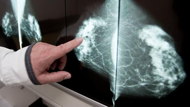 Ultraschall nach Mammographie: Warum ist er noch notwendig? Ultraschall nach Mammographie: Warum ist er noch notwendig?