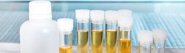 3. Bedeutung der Urinprobe: Was kann sie über die Gesundheit aussagen? 3. Bedeutung der Urinprobe: Was kann sie über die Gesundheit aussagen?