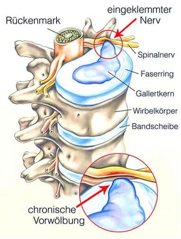 Ganzheitliche Behandlung von Rückenschmerzen durch Osteopathie Ganzheitliche Behandlung von Rückenschmerzen durch Osteopathie