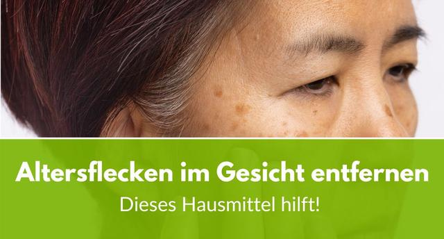 Altersflecken entfernen: Effektive Methoden und Hausmittel Altersflecken entfernen: Effektive Methoden und Hausmittel