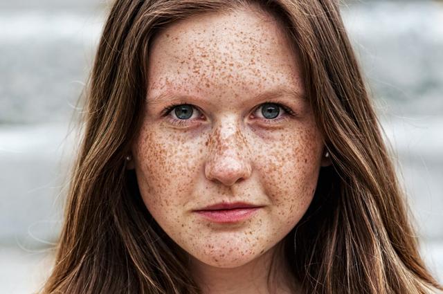 Tipps zur Behandlung von Altersflecken: Was wirklich hilft Tipps zur Behandlung von Altersflecken: Was wirklich hilft