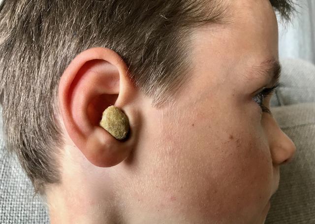 Natürliche Behandlungsmethoden bei Mittelohrentzündung