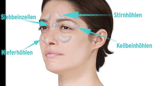 Natürliche und medizinische Behandlungsmethoden bei Sinusitis Natürliche und medizinische Behandlungsmethoden bei Sinusitis
