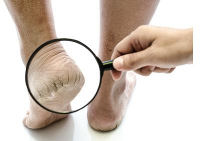 Wann sollte eine podologische Behandlung in Betracht gezogen werden? Wann sollte eine podologische Behandlung in Betracht gezogen werden?