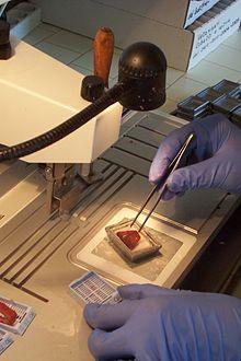 Die Bedeutung der Pathologie für die Verbesserung der Behandlung von Krankheiten Die Bedeutung der Pathologie für die Verbesserung der Behandlung von Krankheiten