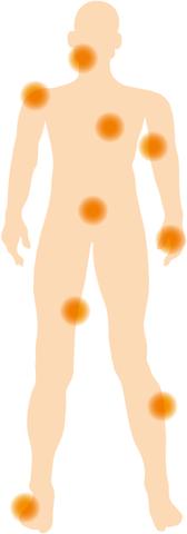 5. Sarkome: Bedeutung der richtigen Diagnose und interdisziplinären Behandlung 5. Sarkome: Bedeutung der richtigen Diagnose und interdisziplinären Behandlung
