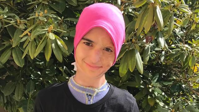 Wie entstehen Trockenblitze und warum sind sie gefährlich? Wie entstehen Trockenblitze und warum sind sie gefährlich?