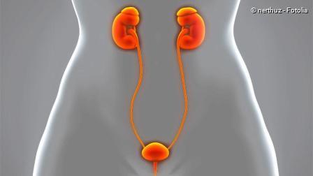 Ursachen und Symptome einer Fistel: Eine umfassende Übersicht