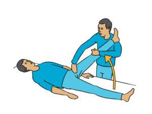 Kontraktur: Definition, Symptome und Behandlungsmöglichkeiten