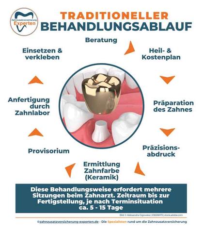 Kosten für Zahnkronen: Eigenanteil und Härtefall-Regelung Kosten für Zahnkronen: Eigenanteil und Härtefall-Regelung