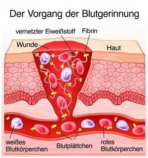 Die Bedeutung von Fibrin für die Blutstillung und Wundheilung Die Bedeutung von Fibrin für die Blutstillung und Wundheilung