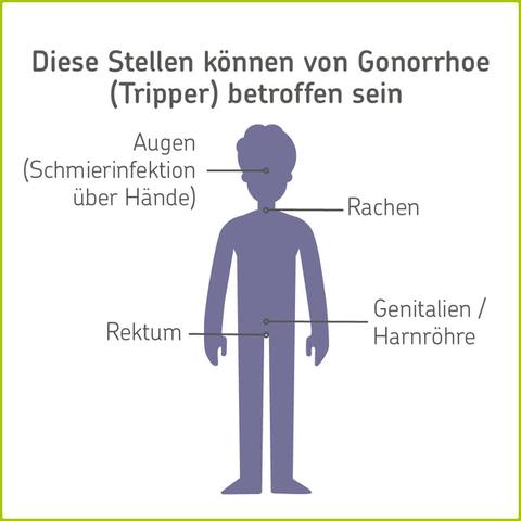 Wie wird Gonorrhö übertragen? Informationen zur Ansteckungsgefahr und Prävention
