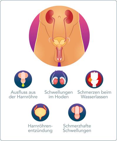 Folgen unbehandelter Gonorrhö: Die langfristigen Auswirkungen der Infektion