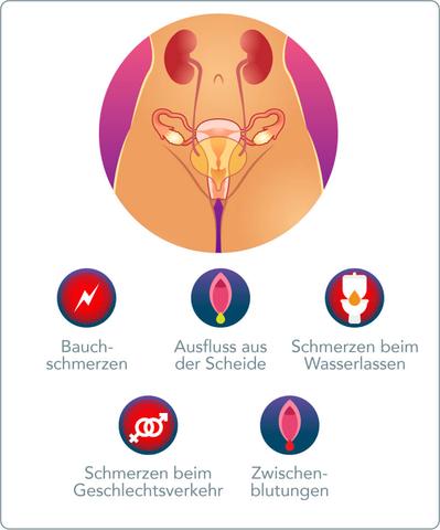 Was ist Gonorrhö? Eine umfassende Erklärung der sexuell übertragbaren Infektion